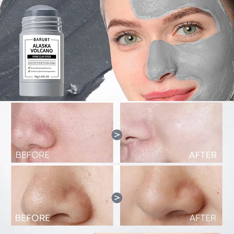 Volcano Pore Cleansing Clay Stick Mask