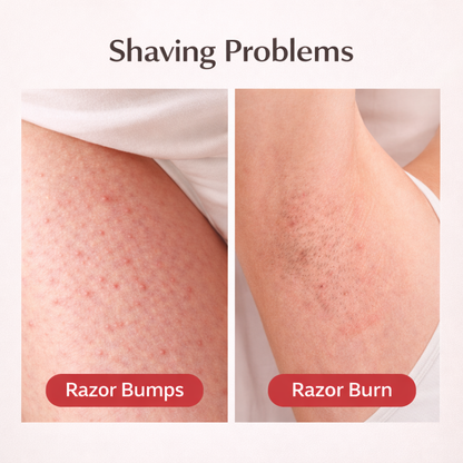 Hair Removal Essential Oil
