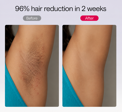 NacoVela™ Cyperus Rotundus Hair Reduction Oil | Post-Shave Hair Care