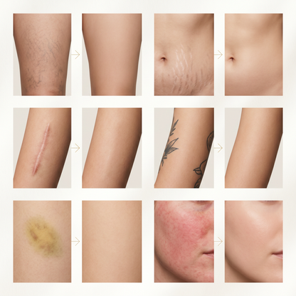 NacoVela Body Veil™  Waterproof Body Perfector
