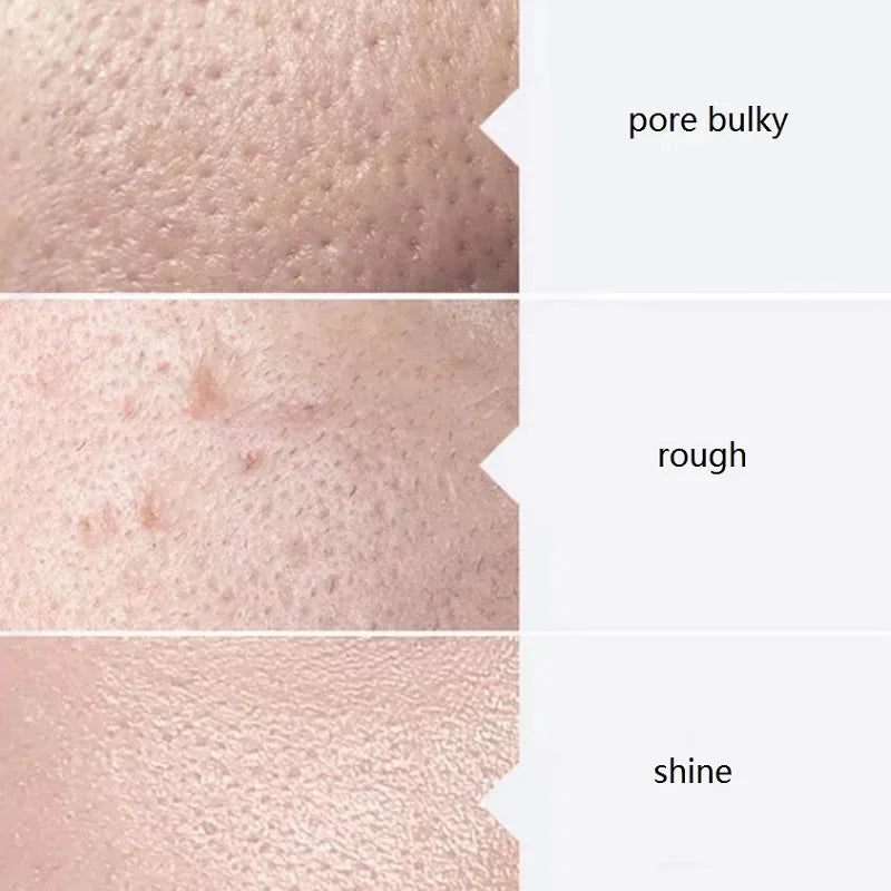 Facial Skincare Face Serum AS1 SA2 AO3 Aqua Peel Solution.